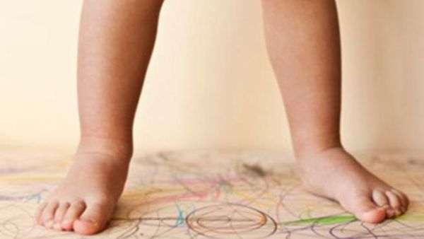 هل أنتِ السبب في اعوجاج قدم طفلك؟