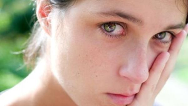 صورة تعبيرية لسيدة معنفة 