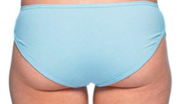 السيلوليات مشكلة تعاني منها 1 من كل 10 نساء