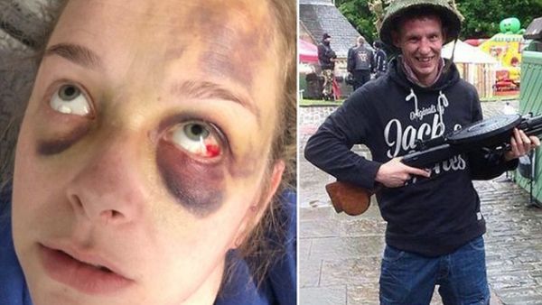 Former soldier headbutted his girlfriend leaving her with horrific face injuries (Twitter)
