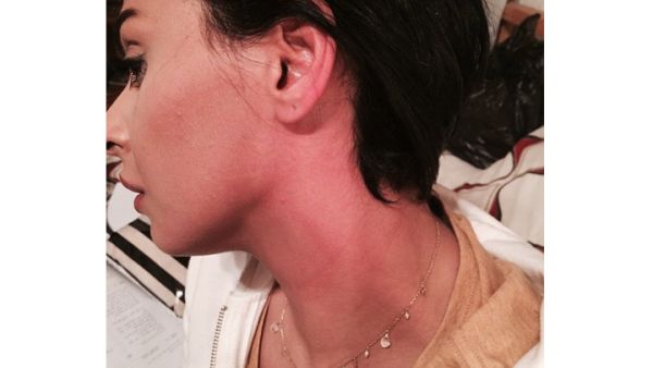 Mais Hamdan shows off her red neck after a hard day of filming. (Image: Facebook)
