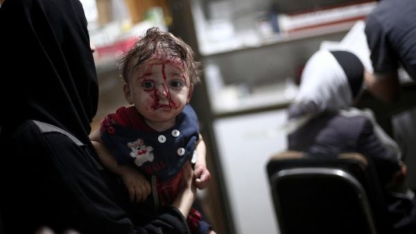 An injured child waits for treatment following reported shelling in Douma (AFP/ File Photo)
