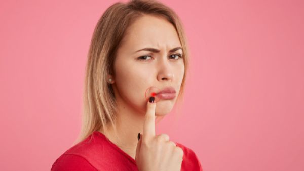 القرح تحدث نتيجة تآكل جزء من طبقة الأغشية المخاطية المبطنة للفم