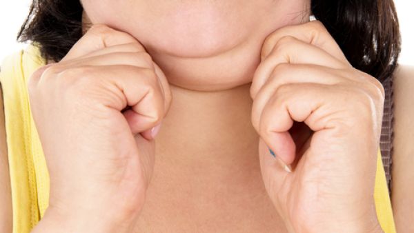 يمكن إخفاء دهون أي جزء من الجسم بارتداء الملابس باستثناء دهون الذقن