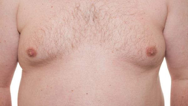 ظهور ثدي في جسد الرجل، يعد خبرًا سيئًا للغاية

