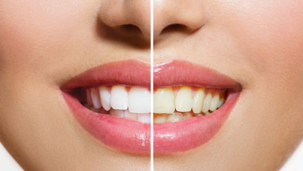 تحتوي الفراولة على نسبة عالية من الفيتامين C 
