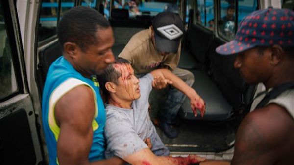 This image, taken on August 10, 2016, shows a refugee injured during protests at an Australian detention facility on Manus Island. (AFP/File)