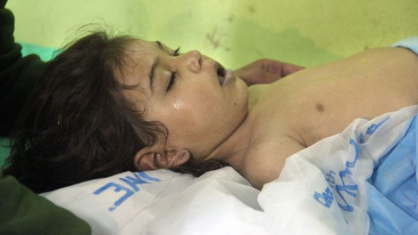 A girl in hospital in the northwestern Syrian, following a suspected toxic gas attack (AFP/File Photo)