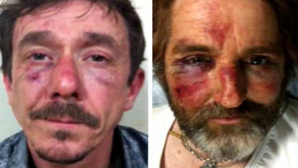  انثوني لويد مراسل صحيفة “تايمز″ الذي اعتقله مقاتلو المعارضة مع زميل له في 2014