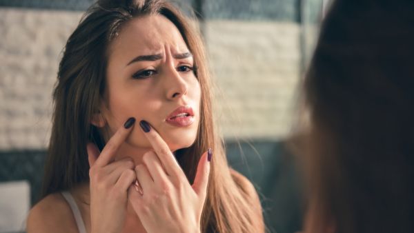 حب الشباب من أكثر المشاكل التي تسبّب الإحراج للعديد من الأشخاص
