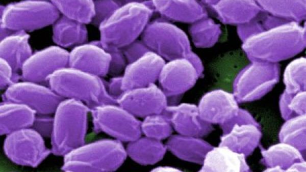 صورة مجهرية جراثيم من سلالة ستيرن من بكتيريا الجمرة الخبيثة الحية
