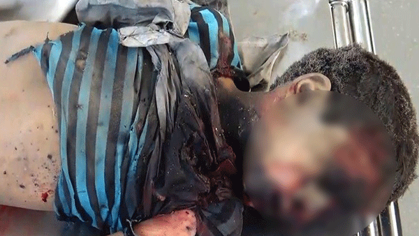 Attack on school bus in Yemen (Twitter)