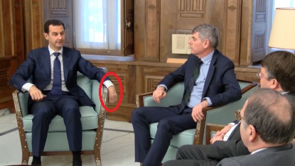 يد الأسد اليسرى أثارت جدلا واسعا حول احتمالية إصابته بجلطة