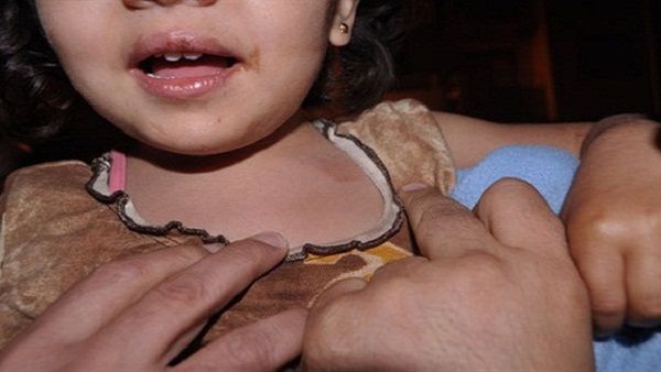 إغتصاب طفلة