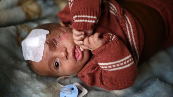 تحدث المرصد الاثنين عن مقتل 80 مدنيا، بينهم ستة أطفال