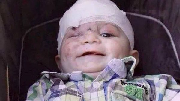 سيدة سورية وأطفالها الثلاثة قتلوا جراء إلقاء الطيران المروحي برميلا متفجرا في بلدة تادف