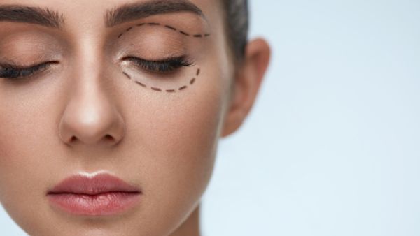  مشكلة الهالات السوداء قد تكون مرضية