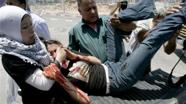 ناشطة سلام اميركية اصيب بعينها خلال تظاهرة اليوم في مخيم قلنديا في الضفة الغربية احتجاجا على الهجوم الاسرائيلي/أ.ف.ب