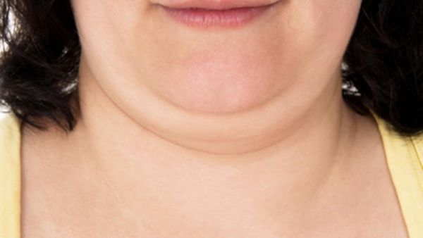 تستخدم بعض أقنعة الوجه كوسيلة للتخلص من الدهون حول منطقة الذقن