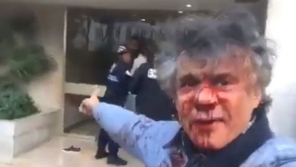 نكاز بعد الاعتداء عليه
