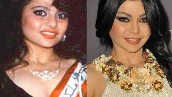 So she DID have plastic surgery after all. (Plastic Surgery Hits)
