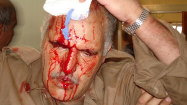 اض اسباني سيحقق في اعمال عنف ارتكبها جنود وشرطيون عراقيون في معسكر اشرف