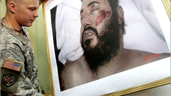 صورة للزرقاوي بعد مقتله- ارشيف