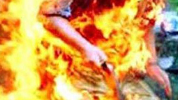 نسبة الحروق في جسد روبين وصلت إلى 90 بالمئة