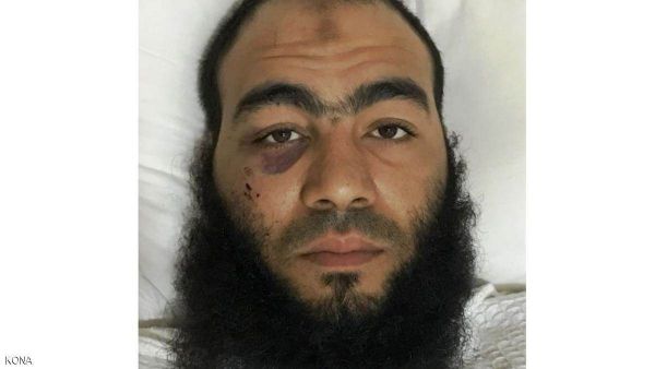 الكويت تعتقل شخصاً يعتقد أنه متشدد إسلامي بعد هجوم بسيارة على أمريكيين