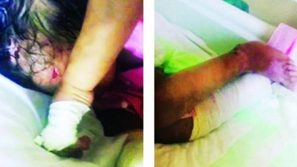 الطفلة المعفنة ليان