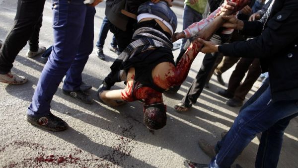 Egyptian protesters carry their gravely injured comrade during clashes with riot police near Tahrir Square in Cairo on March 9, 2013. Two protesters were killed in the clashes in Cairo --one from bird shot and one from suffocation. (AFP PHOTO / MAHMOUD KHALED)