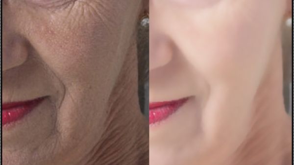 اخفاء التجاعيد