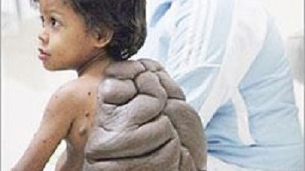 الطفل السلجفاة وامه