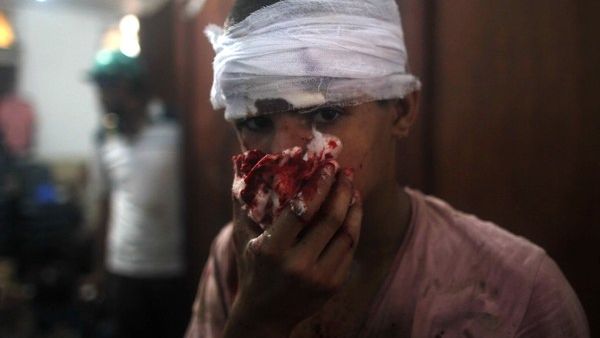 An injured Egyptian youth is seen at a makeshift hospital during clashes between supporters of Egypt's ousted president Mohamed Morsi and police in Cairo on Wednesday. (AFP)