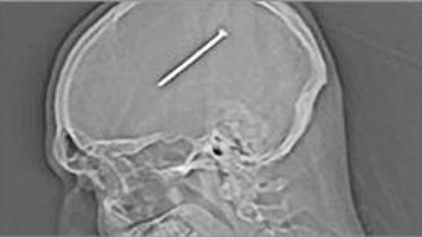 المسمار داخل الراس