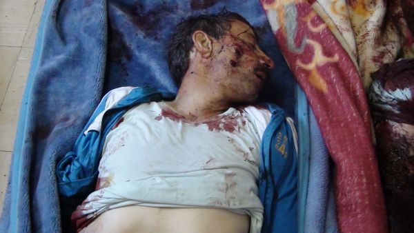A  man who was allegedly killed in mortar attacks at Camp Liberty, an exile camp housing Iranian dissidents near the Iraqi capital Baghdad, on February 9. Assailants fired dozens of mortars and rockets at the camp in a dawn attack that killed five people, the first deaths from violence since they resettled near Baghdad last year. (AFP Photo/HO/Mujahedeen-e-Khalq)