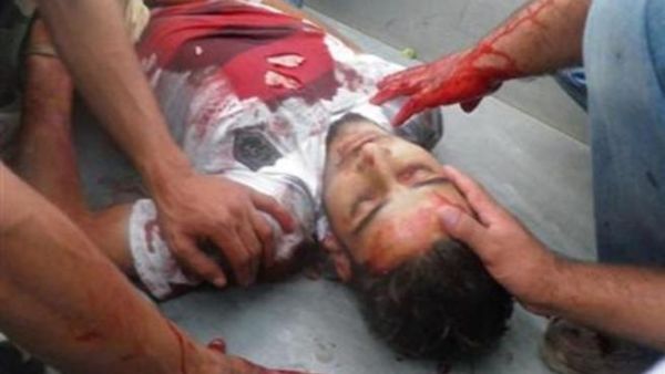 جثمان شاب يقول سكان انه لاقى حتفه في قصف مسجى في مستشفى متنقل بالحولة قرب حمص
