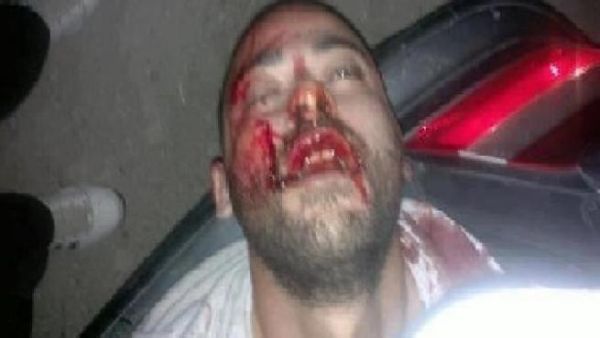 Mohammad Rafea covered in blood