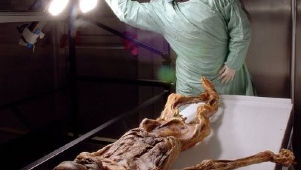 صورة لرجل الجليد "اوتزي" خلال معاينته في المتحف 
