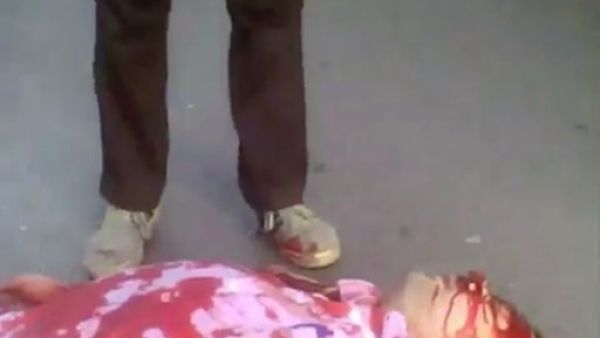 دماء تغطي وجه رجل قتل  برصاص قناص في حمص