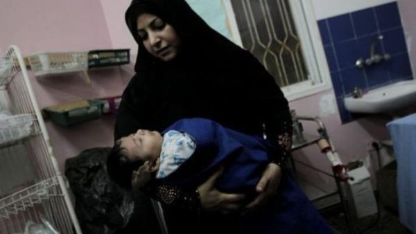 طفل من جرحى الغارة على غزة 