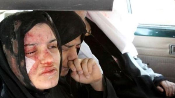 امراة سورية جريحة