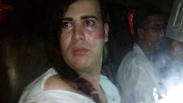 ارجاء محاكمة شاب مثلي وثلاثة معتدين عليه في المغرب