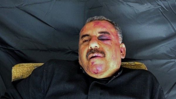   تبنى تنظيم "جبهة النصرة" العملية وأعلن عن أسر الطيار 