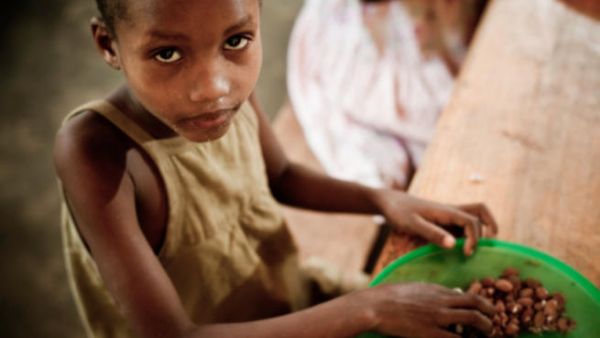 Children in Darfur, Sudan suffering from malnutrition