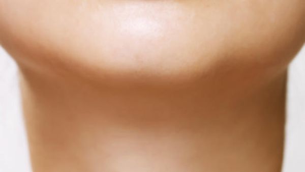 Because the skin on the neck is much thinner than that of other areas on the face, it ages more readily Because the skin on the neck is much thinner than that of other areas on the face, it ages more readily