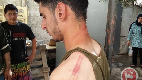 صورة للشاب الذي اعتدى عليه رجال الشرطة- عن وكالة معا