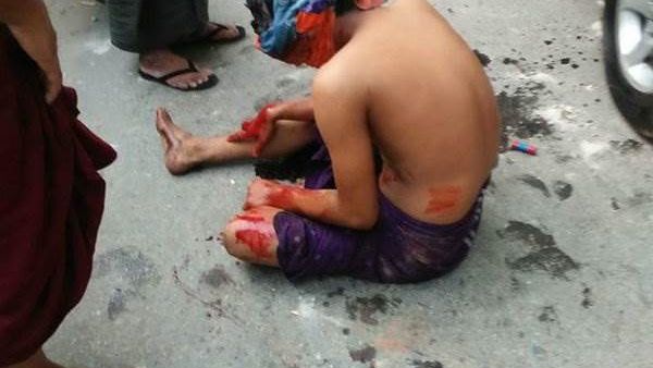 هكذا يُعذب مسلمو الروهنجيا في ميانمار قبل قتلهم !