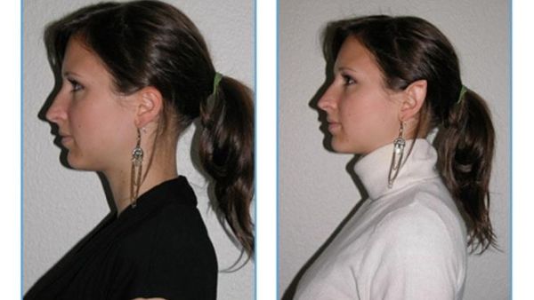 دققوا النظر في الاذن اللي ع اليمين