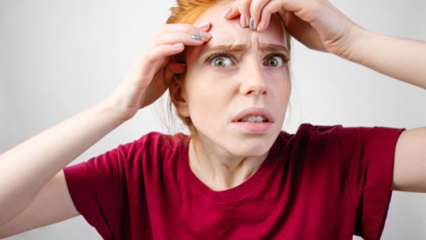 تعد آثار حبوب الوجه من أكثر المشاكل المنتشرة بين الناس (shutterstock.com) تعد آثار حبوب الوجه من أكثر المشاكل المنتشرة بين الناس (shutterstock.com)